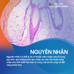 Viêm nội mạc tử cung 3