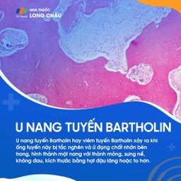 U nang tuyến Bartholin 1