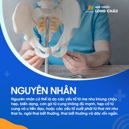 Chuyển dạ đình trệ 5