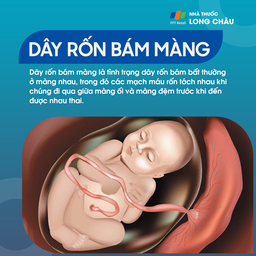 Dây rốn bám màng 1