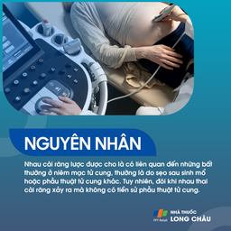 Nhau cài răng lược 3