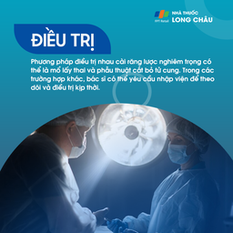 Nhau cài răng lược 6