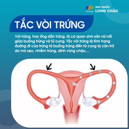Tắc vòi trứng 1