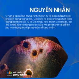 U bì buồng trứng 3