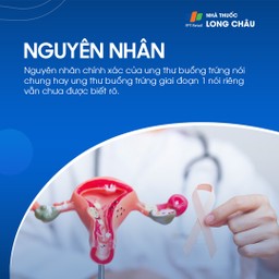 Ung thư buồng trứng giai đoạn 1 - 3