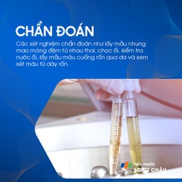 Hội chứng Down 6