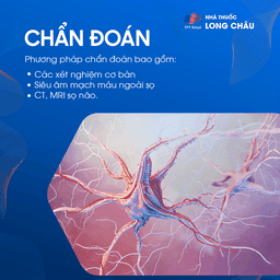 Chẩn đoán rối loạn tiền đình thông qua xét nghiệm thăng bằng và kiểm tra tai trong