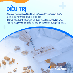 Điều trị sỏi thận - Phương pháp tán sỏi và phẫu thuật loại bỏ sỏi thận