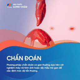 Chẩn đoán xơ gan - Quy trình kiểm tra và xác định tình trạng xơ gan