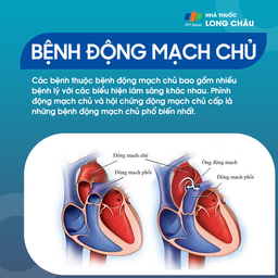 Động mạch chủ, động mạch phổi và ống động mạch trên tim