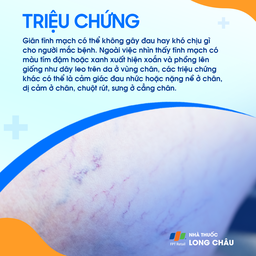 Giãn tĩnh mạch 2