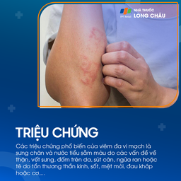 Viêm đa vi mạch 2