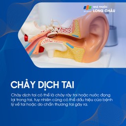 Chảy dịch tai có thể do ráy tai, nước đọng, hoặc là dấu hiệu bệnh lý – chấn thương tai