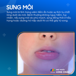 Sưng môi 1