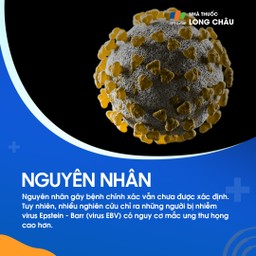 Nguyên nhân chính xác chưa rõ, nhưng virus Epstein–Barr có thể làm tăng nguy cơ ung thư họng