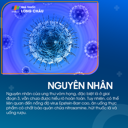 Ung thư vòm họng giai đoạn 3 - 3