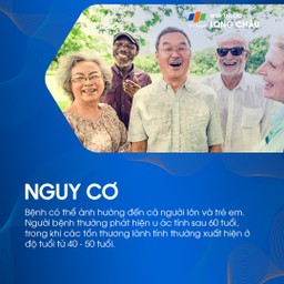 U tuyến nước bọt mang tai 6