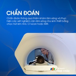 U tuyến nước bọt mang tai 7