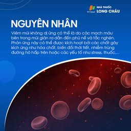 Viêm mũi mãn tính 4