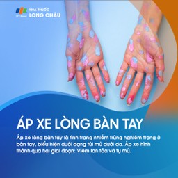 Áp xe lòng bàn tay 1