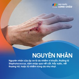 Áp xe lòng bàn tay 3