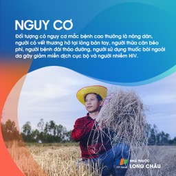 Áp xe lòng bàn tay 4