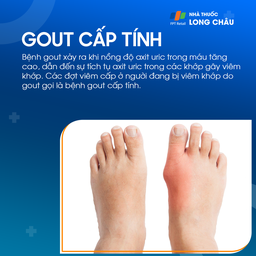Gout cấp tính 1