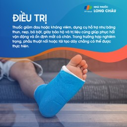 Bong gân cổ chân 7