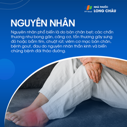 Nguyên nhân đau chân: Đau chân có thể do bàn chân bẹt, bong gân, chuột rút, viêm cơ, bệnh gout, thần kinh hoặc biến chứng tiểu đường