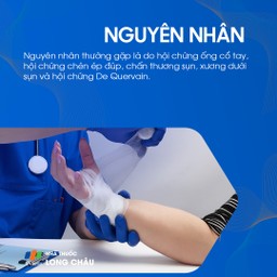 Nguyên nhân đau cổ tay thường là hội chứng ống cổ tay, chèn ép dây thần kinh, tổn thương sụn hoặc hội chứng De Quervain