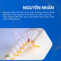 Nguyên nhân gây đau khớp khuỷu tay: Ảnh hưởng từ việc lặp đi lặp lại các động tác tay