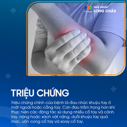 Hội chứng đường hầm xương quay 2