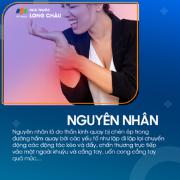 Hội chứng đường hầm xương quay 3