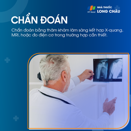 Hội chứng đường hầm xương quay 5