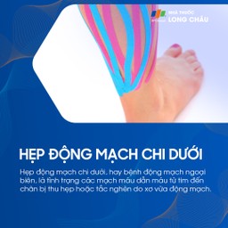 Hẹp động mạch chi dưới 1