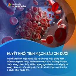 Huyết khối tĩnh mạch sâu chi dưới 1