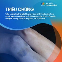 Huyết khối tĩnh mạch sâu 2