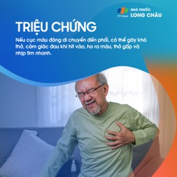 Huyết khối tĩnh mạch sâu 3