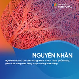 Huyết khối tĩnh mạch sâu 4