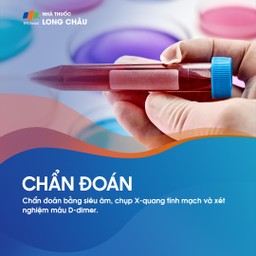 Huyết khối tĩnh mạch sâu 6