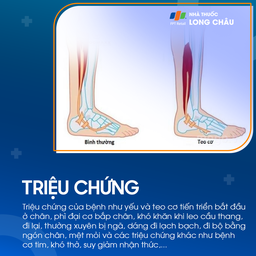 Loạn dưỡng cơ Duchenne 2