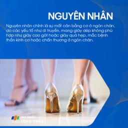 Ngón chân hình búa 3