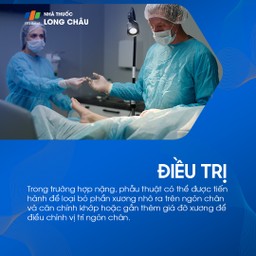 Ngón chân hình búa 7