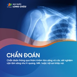 Rách sụn viền khớp vai 5