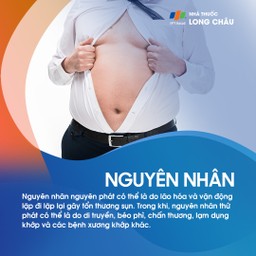 Thoái hóa khớp 3