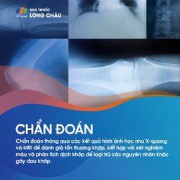 Thoái hóa khớp 5