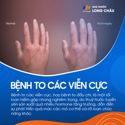 Bệnh to các viễn cực 1