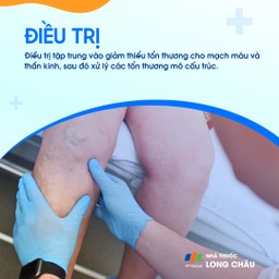 Trật khớp gối 7