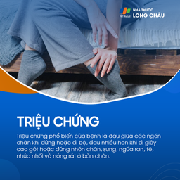 U dây thần kinh morton 2