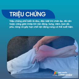 Viêm bao hoạt dịch 2